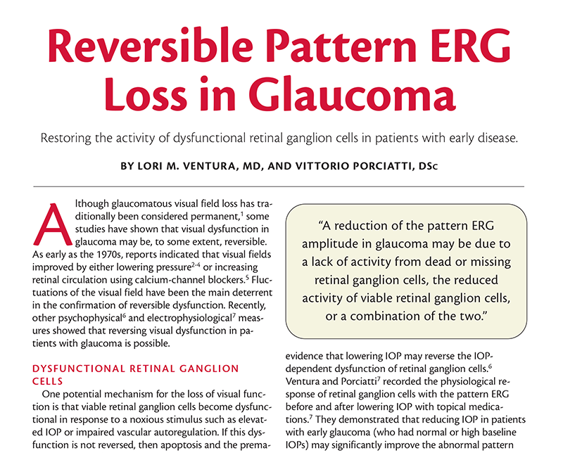 Pattern ERG and Glaucoma