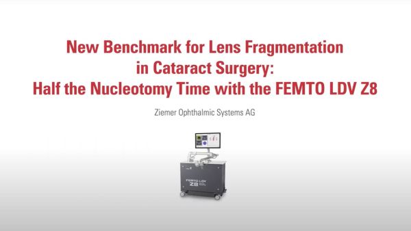 O software Cataract atualizado no FEMTO LDV Z8 estabelece uma nova referência para a fragmentação do cristalino na cirurgia de catarata. Este vídeo mostra que usando este software no FEMTO LDV Z8, o tempo da nucleotomia pode ser reduzido pela metade. 