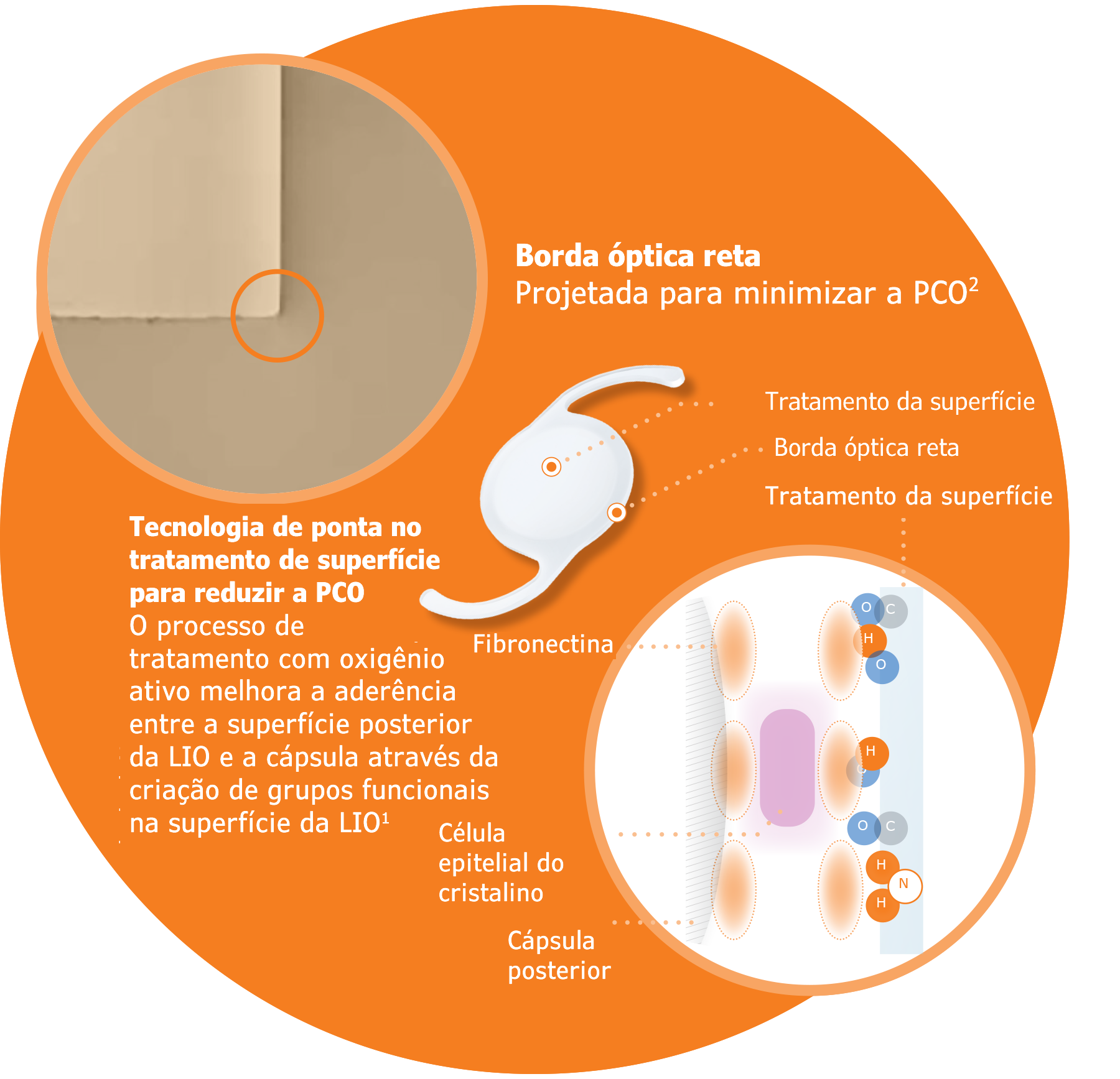 Infográfico PCO