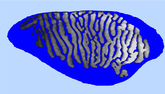 MEIBOGRAFIA 3D