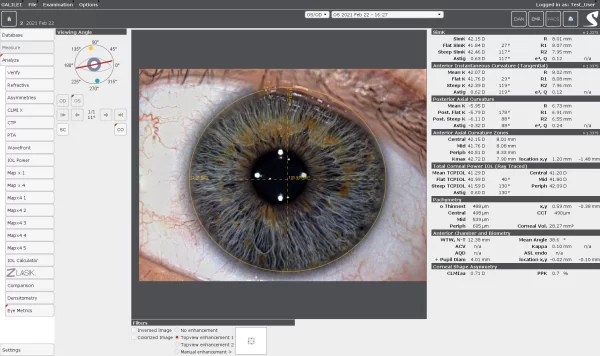 O display Color Eye Metrics pode ser usada para diferentes cirurgias. Podem-se localizar opacidades dentro da córnea.