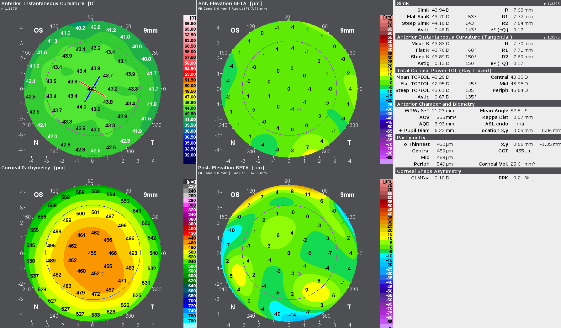 A grande versatilidade do GALILEI ColorZ permite ao usuário criar um display customizável com 1 mapa ou até 5 displays customizáveis com 4 mapas.