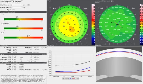 O Santhiago PTA Report™ é uma ferramenta de simulação para prever a probabilidade de formação de ectasia após a cirurgia de LASIK em olhos com topografia pré-operatória normal.